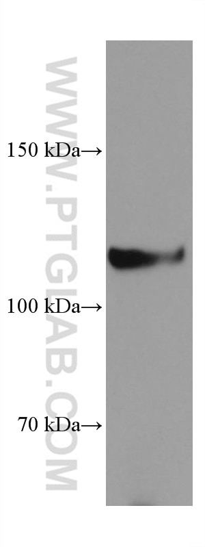 WB analysis of 4T1 using 67060-1-Ig