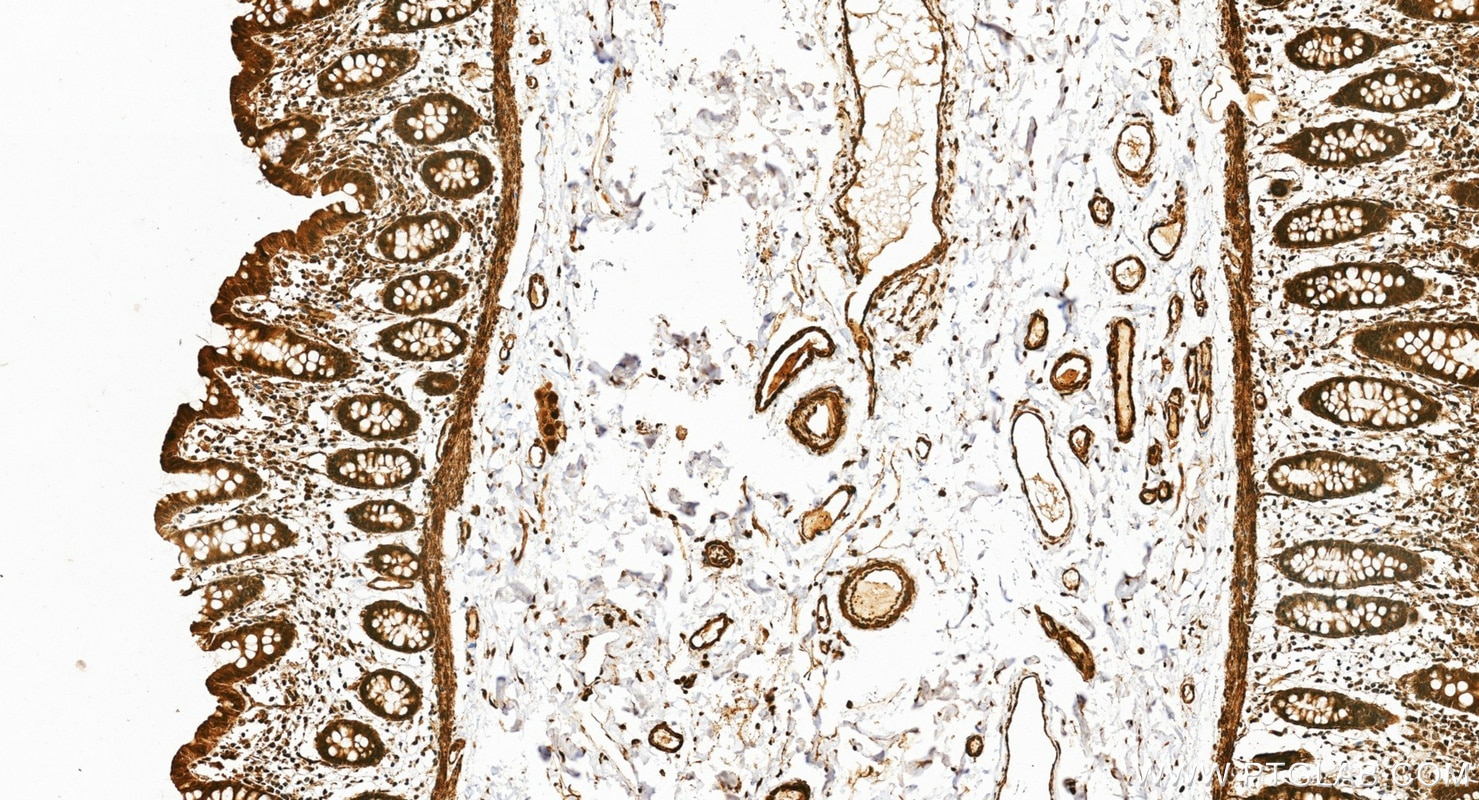 Immunohistochemistry (IHC) staining of human colon tissue using INTS4 Polyclonal antibody (16130-1-AP)