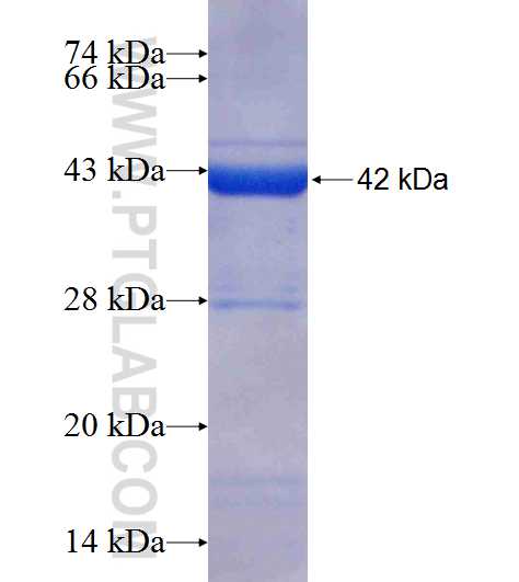 INTS4 fusion protein Ag9385 SDS-PAGE
