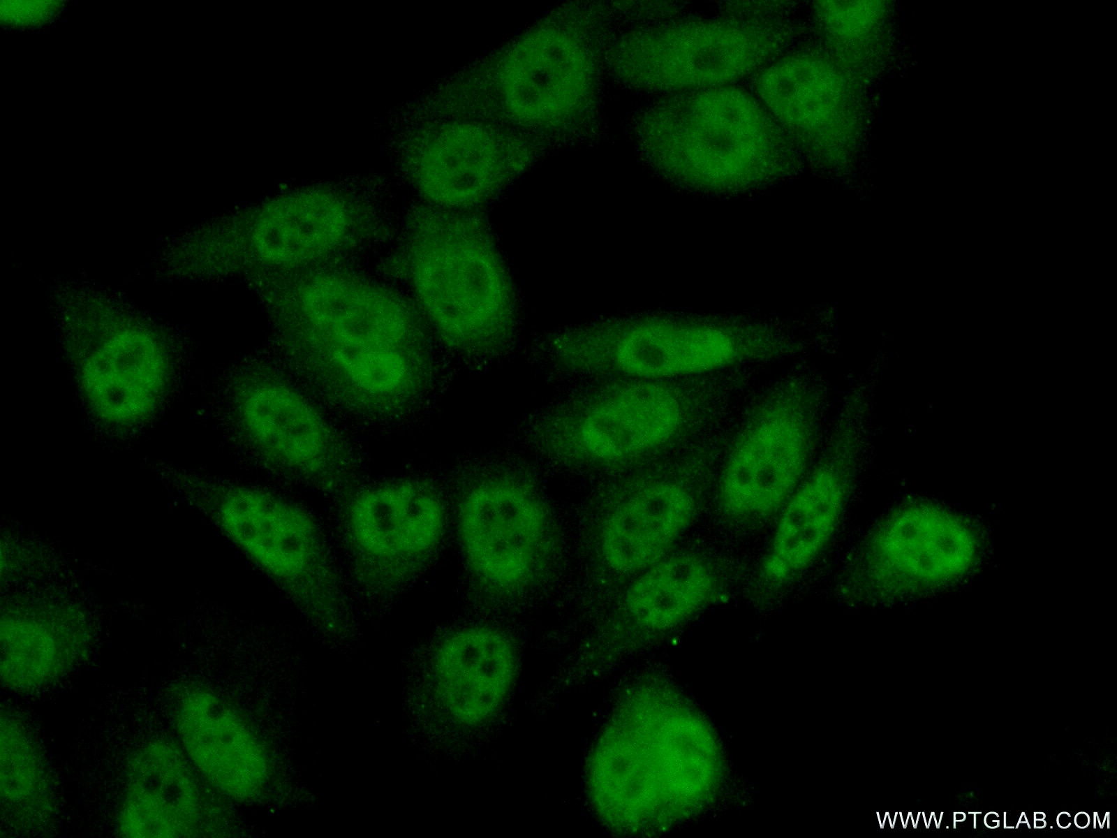 Immunofluorescence (IF) / fluorescent staining of HeLa cells using INTS5 Polyclonal antibody (14069-1-AP)