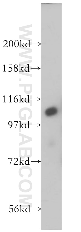 Western Blot (WB) analysis of human brain tissue using INTS5 Polyclonal antibody (14069-1-AP)