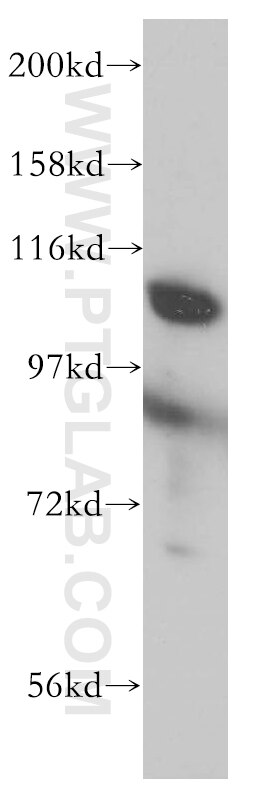 Western Blot (WB) analysis of HeLa cells using INTS5 Polyclonal antibody (14069-1-AP)