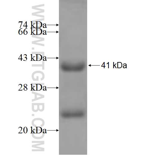 INTS5 fusion protein Ag5798 SDS-PAGE