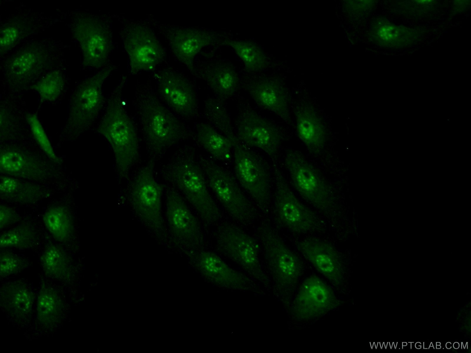 Immunofluorescence (IF) / fluorescent staining of SH-SY5Y cells using INTS7 Polyclonal antibody (17054-1-AP)