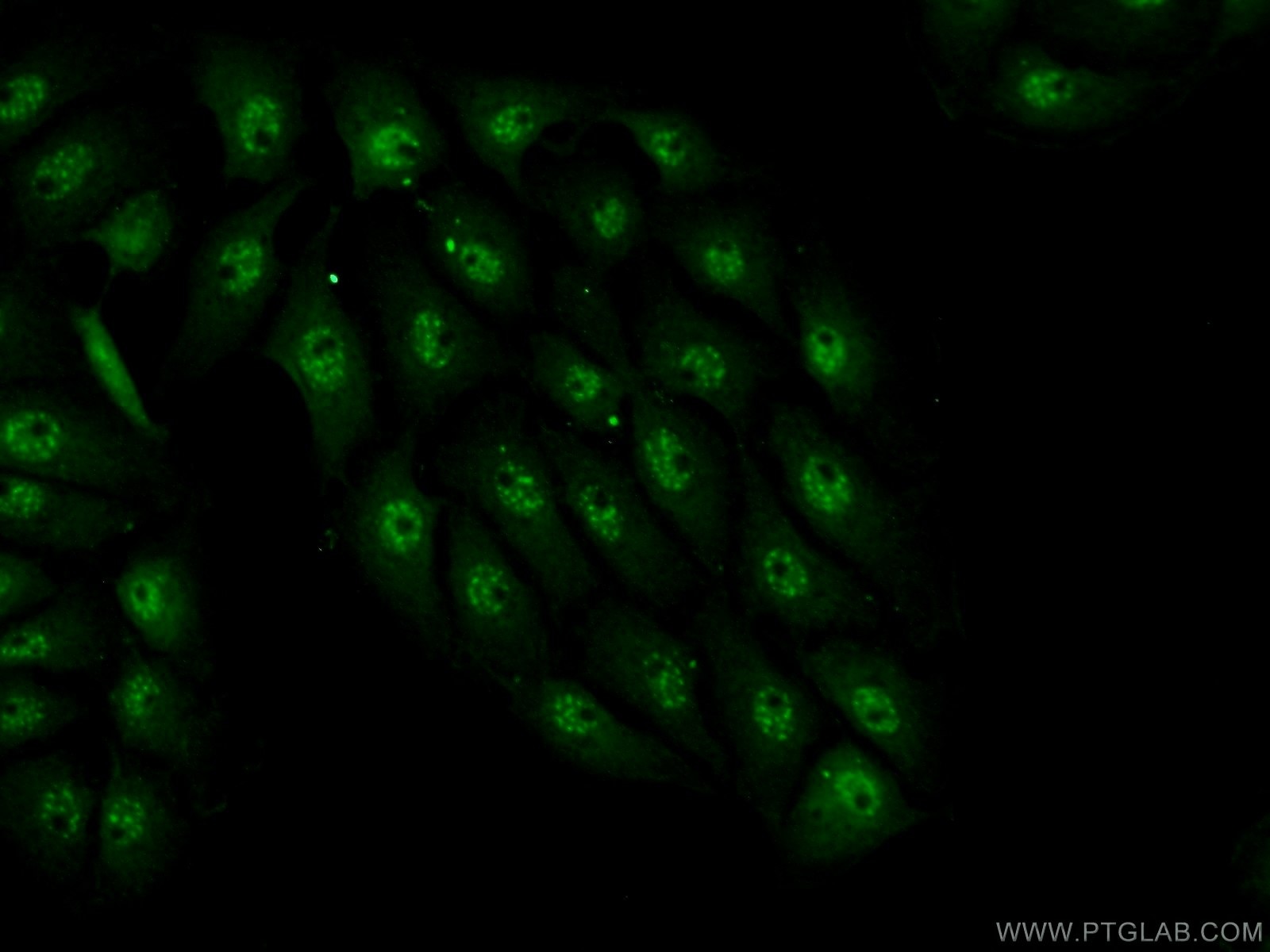 IF Staining of SH-SY5Y using 17054-1-AP