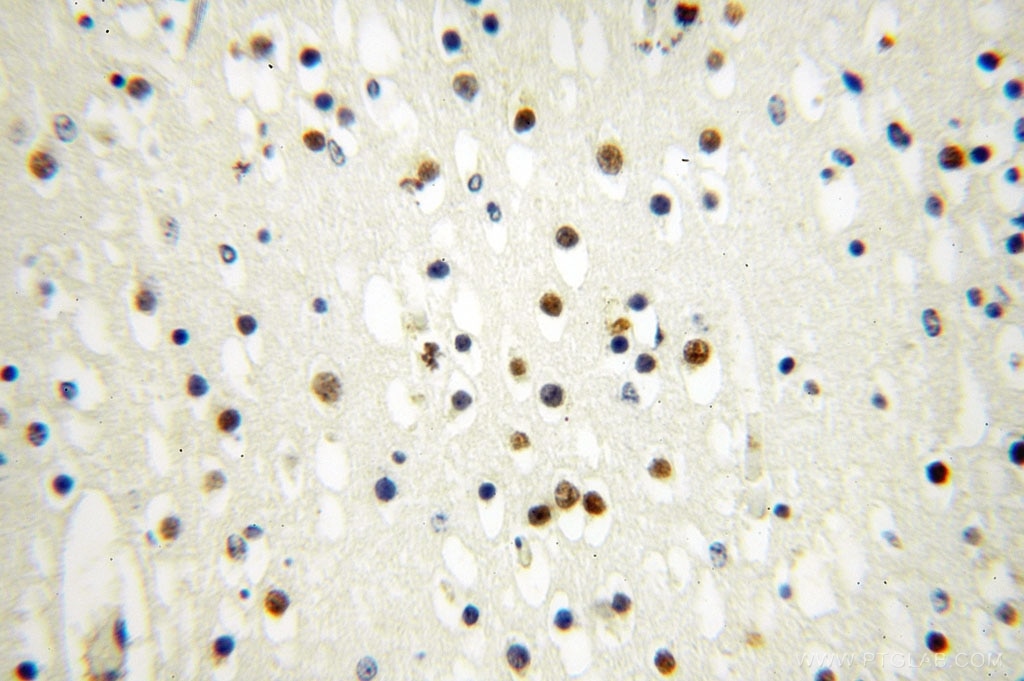 Immunohistochemistry (IHC) staining of human brain tissue using INTS7 Polyclonal antibody (17054-1-AP)