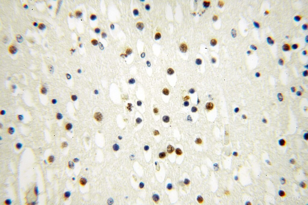 Immunohistochemistry (IHC) staining of human brain tissue using INTS7 Polyclonal antibody (17054-1-AP)