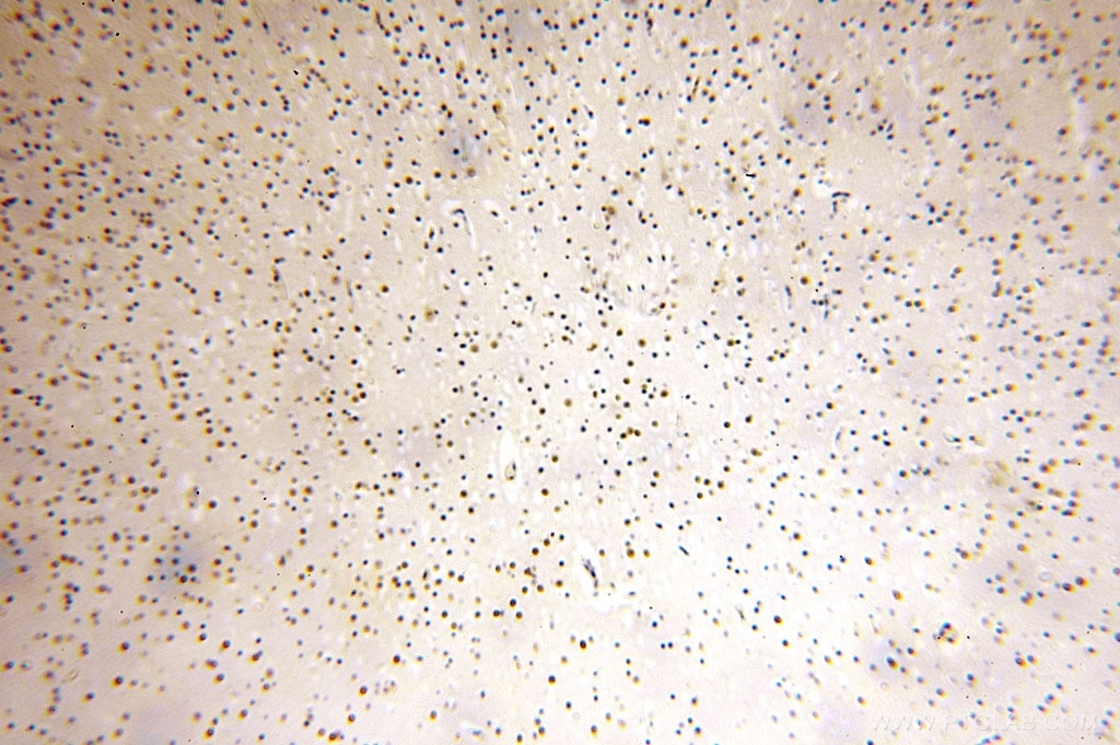 Immunohistochemistry (IHC) staining of human brain tissue using INTS7 Polyclonal antibody (17054-1-AP)