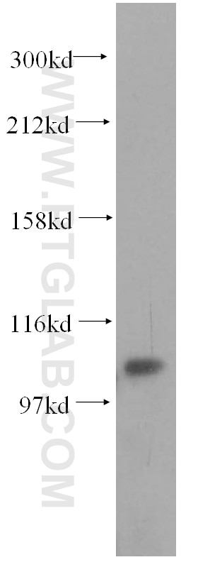 Western Blot (WB) analysis of HEK-293 cells using INTS7 Polyclonal antibody (17054-1-AP)
