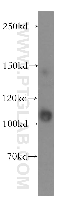 Western Blot (WB) analysis of A431 cells using INTS7 Polyclonal antibody (17054-1-AP)