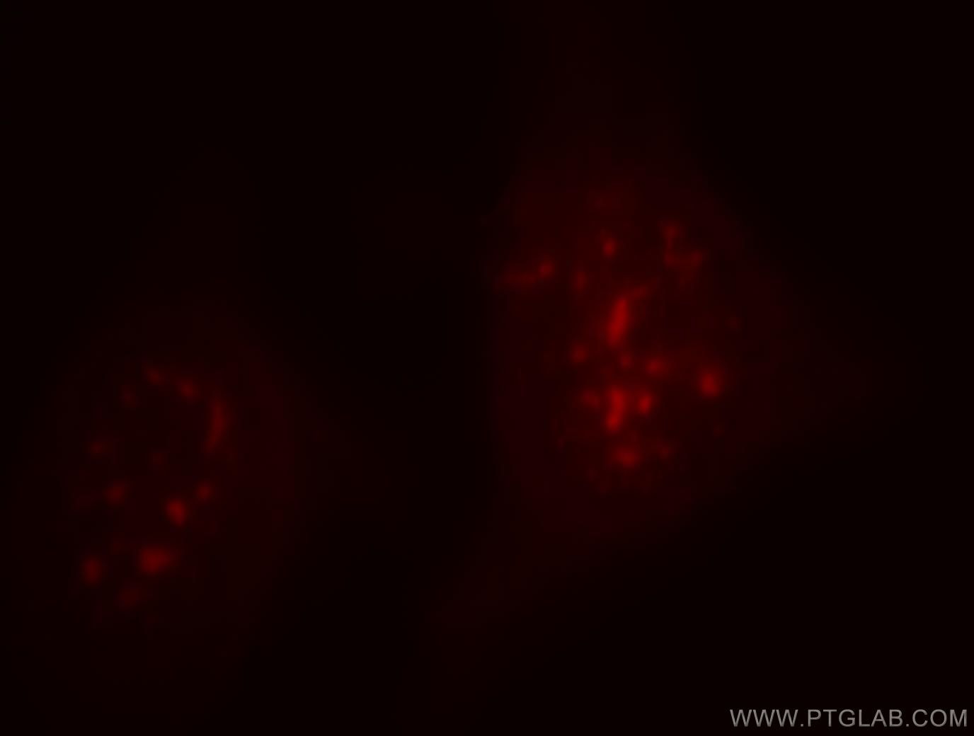 Immunofluorescence (IF) / fluorescent staining of HeLa cells using INTS8 Polyclonal antibody (18802-1-AP)