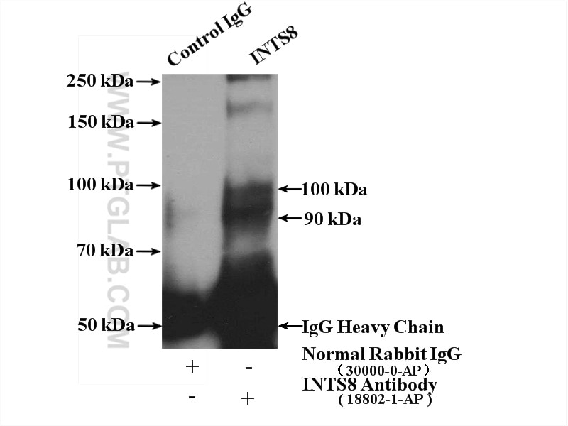 Immunoprecipitation (IP) experiment of HeLa cells using INTS8 Polyclonal antibody (18802-1-AP)