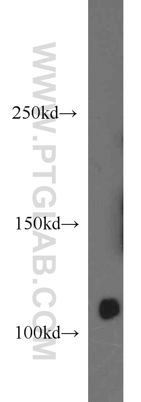 Western Blot (WB) analysis of HeLa cells using INTS8 Polyclonal antibody (18802-1-AP)