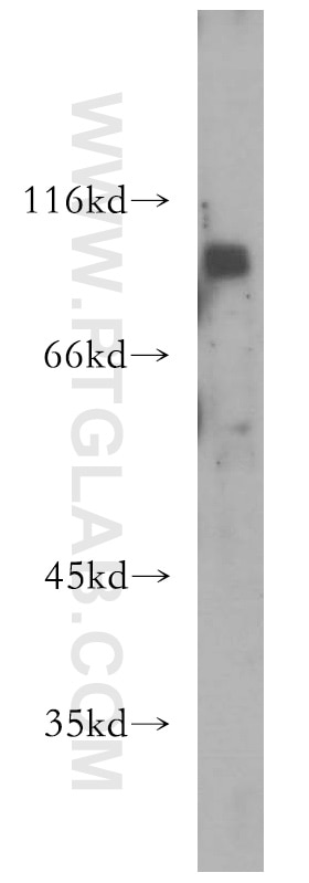 Western Blot (WB) analysis of MCF-7 cells using INTS8 Polyclonal antibody (18802-1-AP)