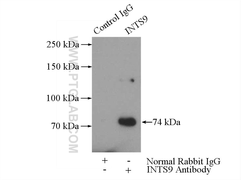 Immunoprecipitation (IP) experiment of HeLa cells using INTS9 Polyclonal antibody (11657-1-AP)