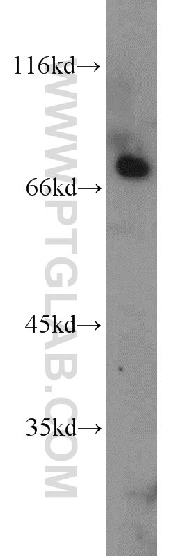 Western Blot (WB) analysis of HEK-293 cells using INTS9 Polyclonal antibody (11657-1-AP)