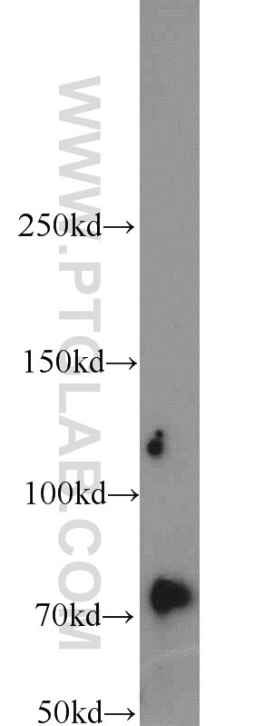 Western Blot (WB) analysis of Jurkat cells using INTS9 Polyclonal antibody (11657-1-AP)