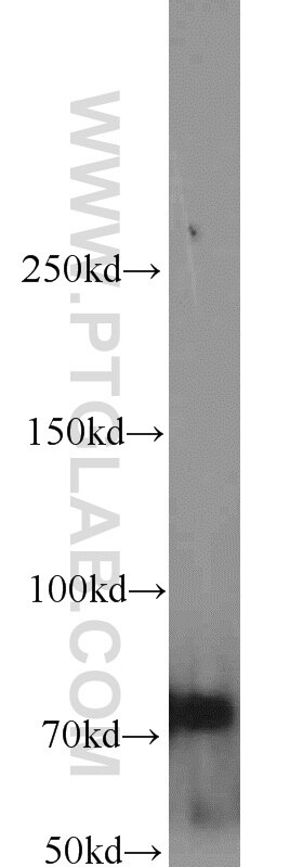 Western Blot (WB) analysis of Jurkat cells using INTS9 Polyclonal antibody (11657-1-AP)