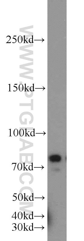 Western Blot (WB) analysis of HeLa cells using INTS9 Polyclonal antibody (11657-1-AP)