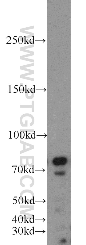 Western Blot (WB) analysis of HeLa cells using INTS9 Polyclonal antibody (11657-1-AP)