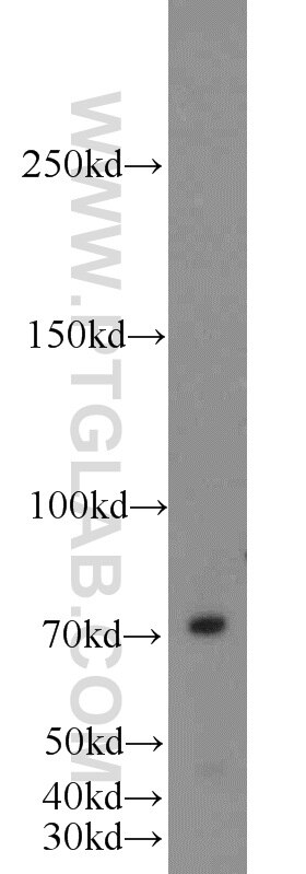 Western Blot (WB) analysis of HEK-293 cells using INTS9 Polyclonal antibody (11657-1-AP)