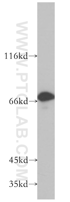 Western Blot (WB) analysis of Jurkat cells using INTS9 Polyclonal antibody (11657-1-AP)