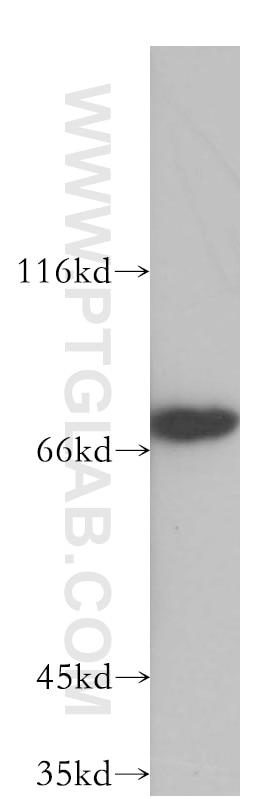 Western Blot (WB) analysis of Jurkat cells using INTS9 Polyclonal antibody (11657-1-AP)