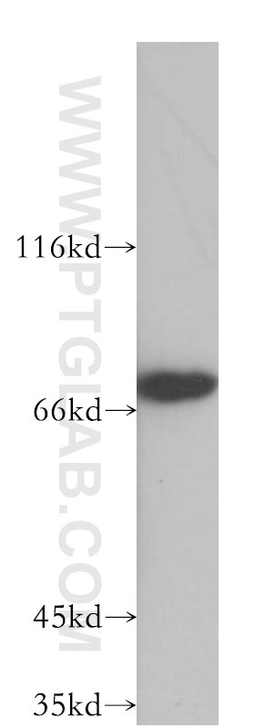 WB analysis of Jurkat using 11657-1-AP