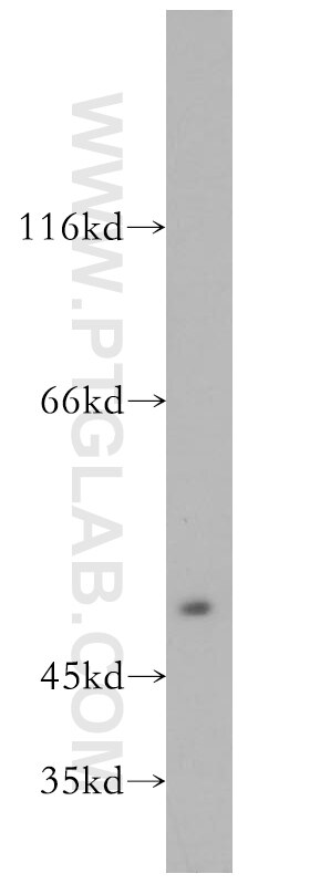 Western Blot (WB) analysis of Jurkat cells using INTS9 Polyclonal antibody (11657-1-AP)