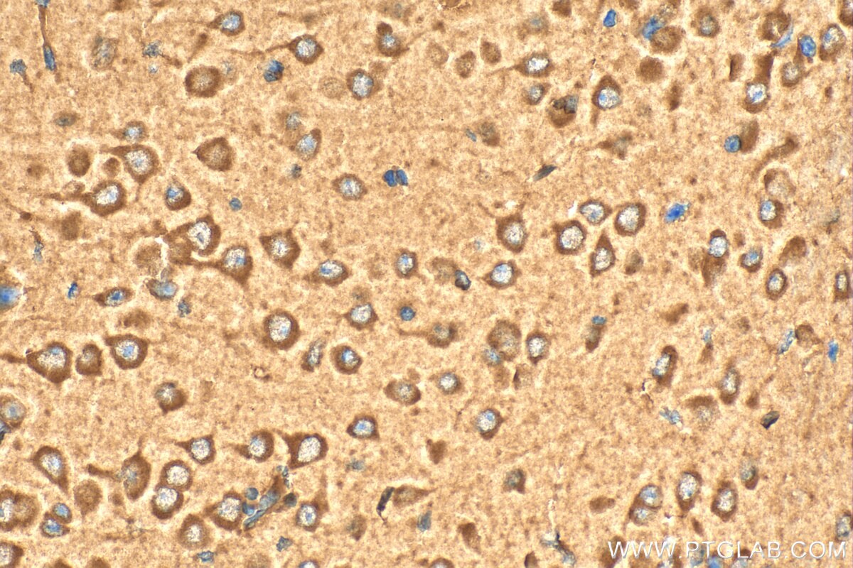 Immunohistochemistry (IHC) staining of mouse brain tissue using INTU Polyclonal antibody (24914-1-AP)