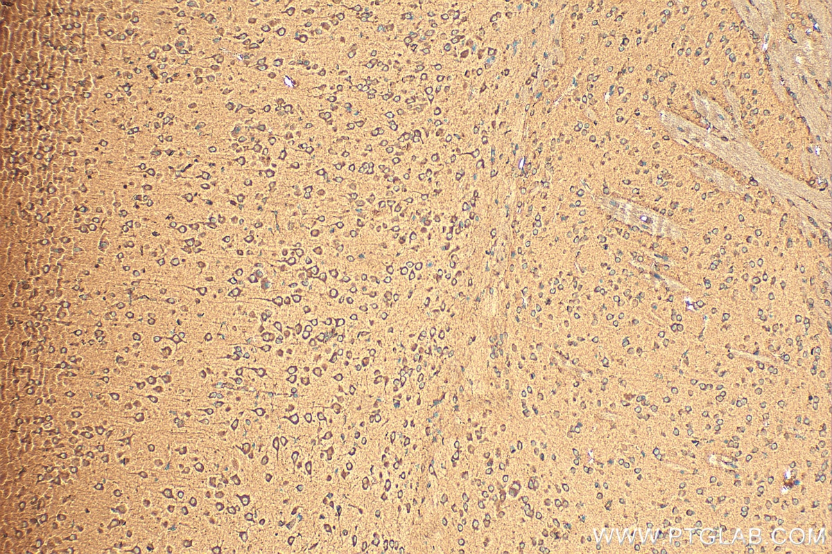 Immunohistochemistry (IHC) staining of mouse brain tissue using INTU Polyclonal antibody (24914-1-AP)