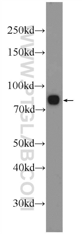 Western Blot (WB) analysis of mouse heart tissue using INTU Polyclonal antibody (24914-1-AP)