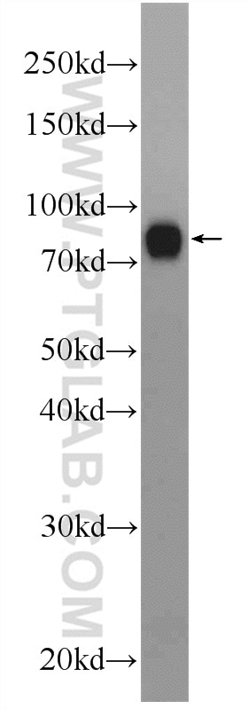 Western Blot (WB) analysis of mouse liver tissue using INTU Polyclonal antibody (24914-1-AP)