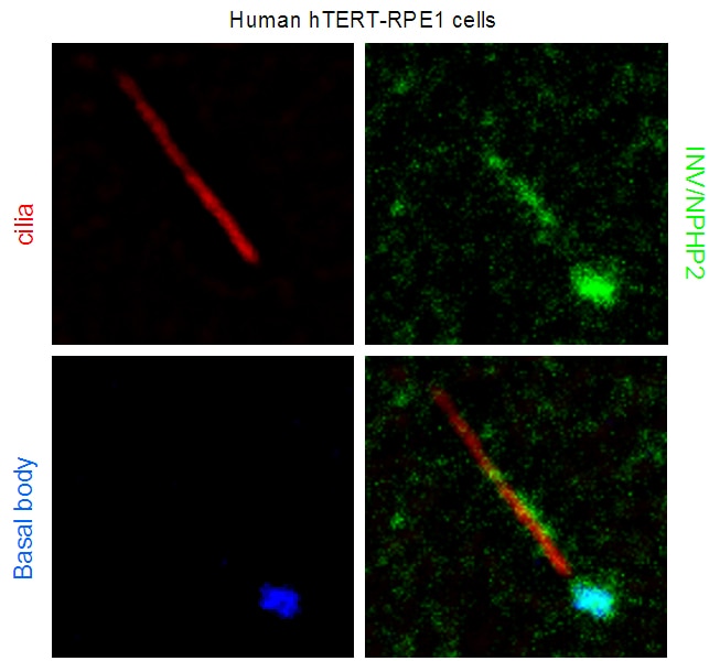 Immunofluorescence (IF) / fluorescent staining of hTERT-RPE1 cells using INVS Polyclonal antibody (10585-1-AP)