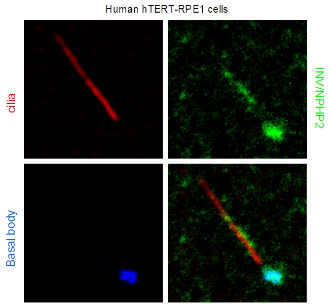 IF Staining of hTERT-RPE1 cells using 10585-1-AP