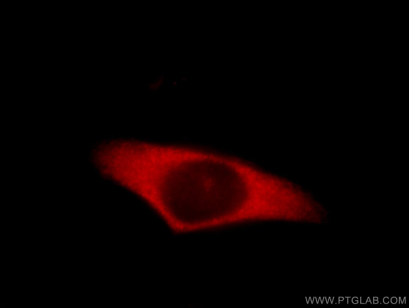 Immunofluorescence (IF) / fluorescent staining of HeLa cells using INVS Polyclonal antibody (10585-1-AP)