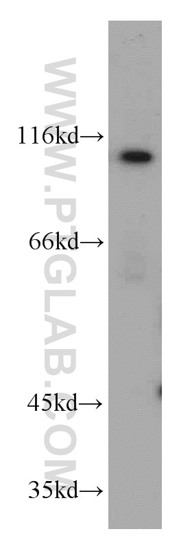 WB analysis of L02 using 10585-1-AP