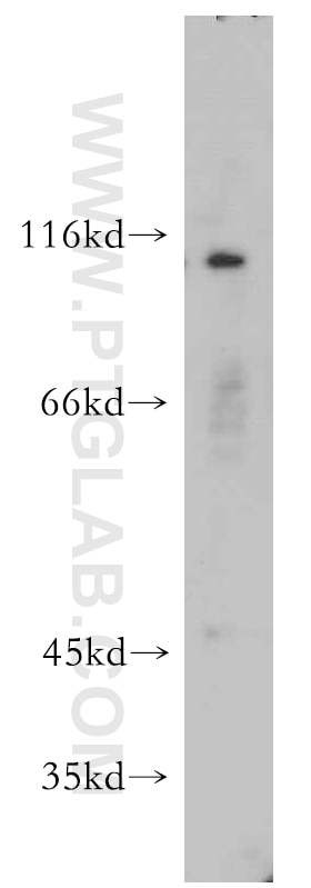 Western Blot (WB) analysis of SH-SY5Y cells using INVS Polyclonal antibody (10585-1-AP)