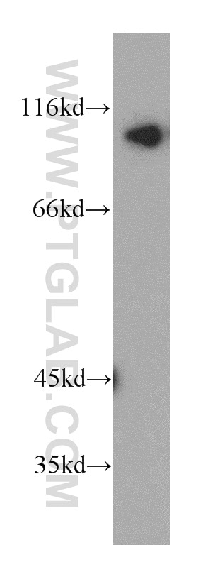 Western Blot (WB) analysis of MCF-7 cells using INVS Polyclonal antibody (10585-1-AP)