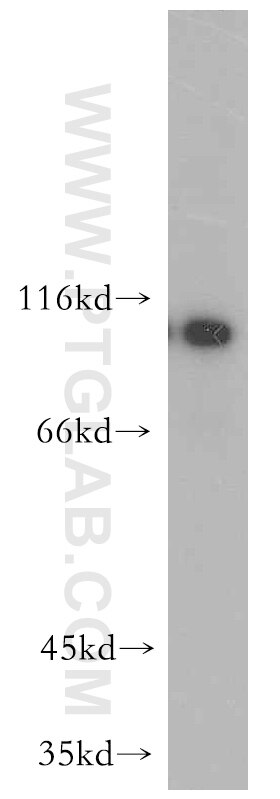 Western Blot (WB) analysis of mouse skeletal muscle tissue using INVS Polyclonal antibody (10585-1-AP)