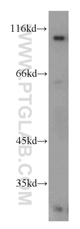 Western Blot (WB) analysis of K-562 cells using INVS Polyclonal antibody (10585-1-AP)