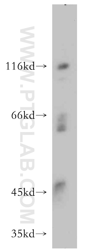 WB analysis of HepG2 using 10585-1-AP