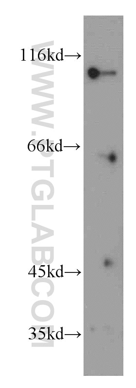 Western Blot (WB) analysis of Raji cells using INVS Polyclonal antibody (10585-1-AP)