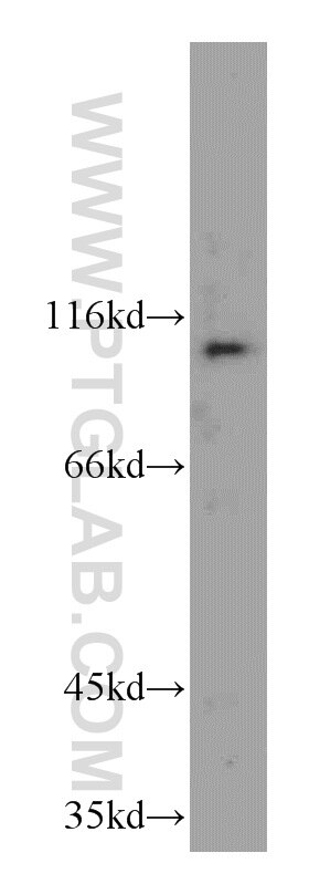 Western Blot (WB) analysis of Jurkat cells using INVS Polyclonal antibody (10585-1-AP)
