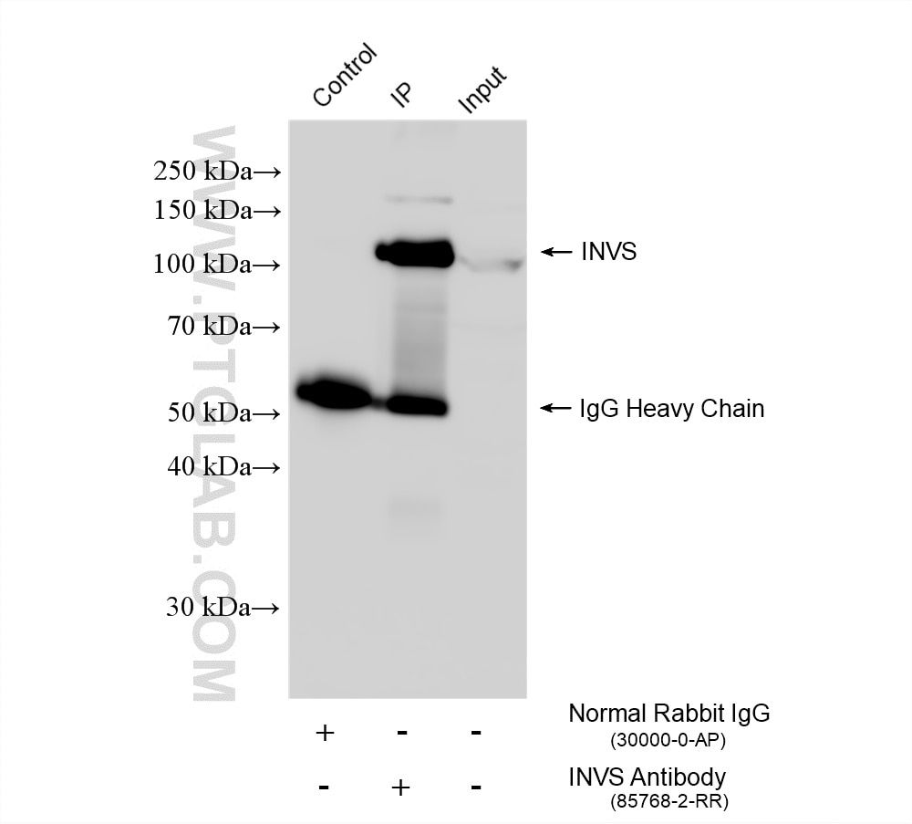 Immunoprecipitation (IP) experiment of K-562 cells using INVS Recombinant monoclonal antibody (85768-2-RR)