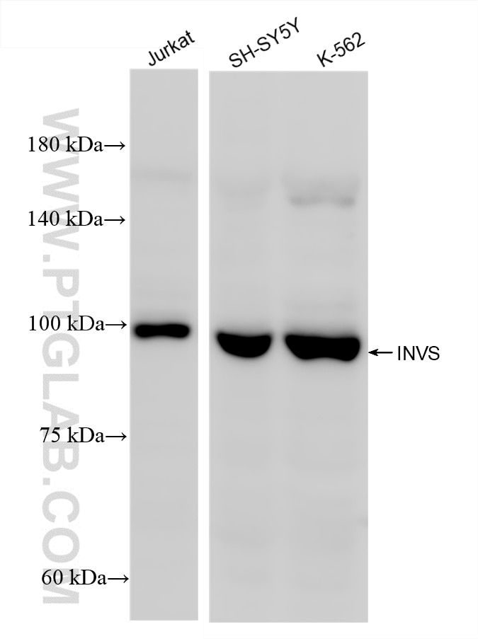 Western Blot (WB) analysis of various lysates using INVS Recombinant antibody (85768-2-RR)