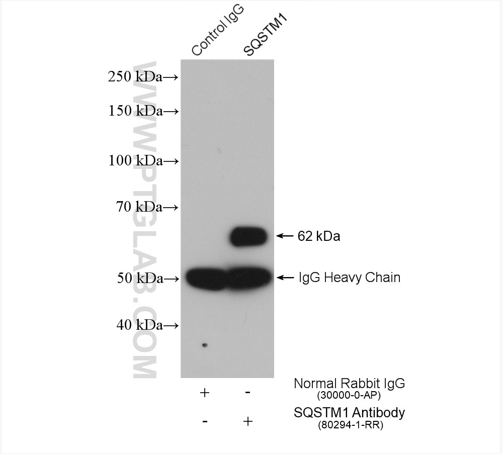 IP result of anti-P62,SQSTM1(IP:80294-1-RR, 4ug; Detection:80294-1-RR 1:500) with HEK-293 cells lysate 1640 ug.