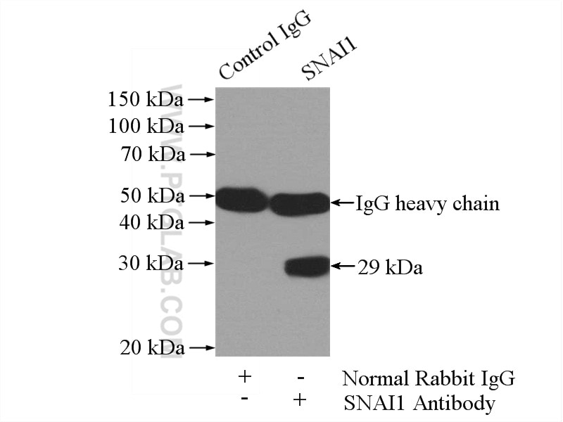IP Result of anti-SNAI1 (IP:13099-1-AP, 4ug; Detection:13099-1-AP 1:600) with MCF-7 cells lysate 1040ug.