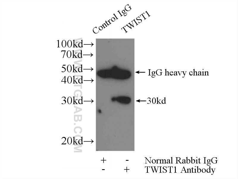 IP Result of anti-TWIST1-specific (IP:25465-1-AP, 4ug; Detection:25465-1-AP 1:500) with MDA-MB-453s cells lysate 920ug.