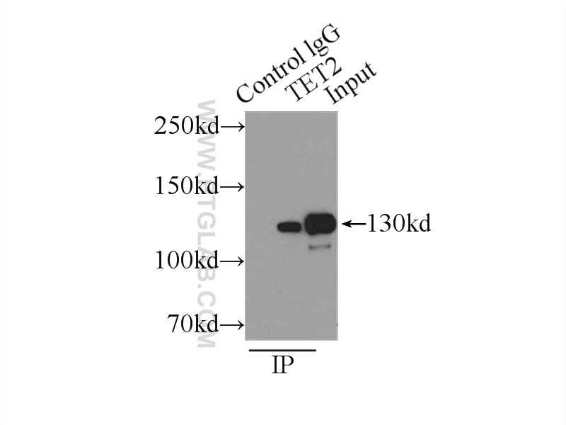 IP result of anti-TET2 (IP:21207-1-AP, 3ug; Detection:21207-1-AP 1:500) with  mouse brain tissue lysate 4000ug.